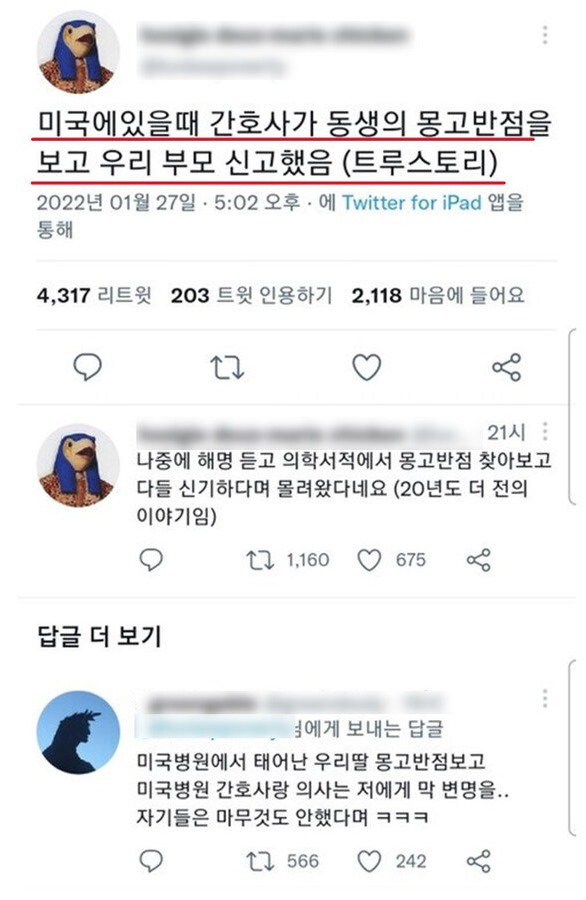 서양의사들이 몽고반점을 보고 자주 오해하는 이유.jpg