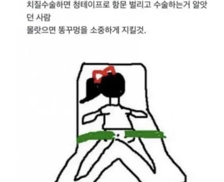 똥구멍을 소중히 여기지 않았던 사람의 최후. jpg